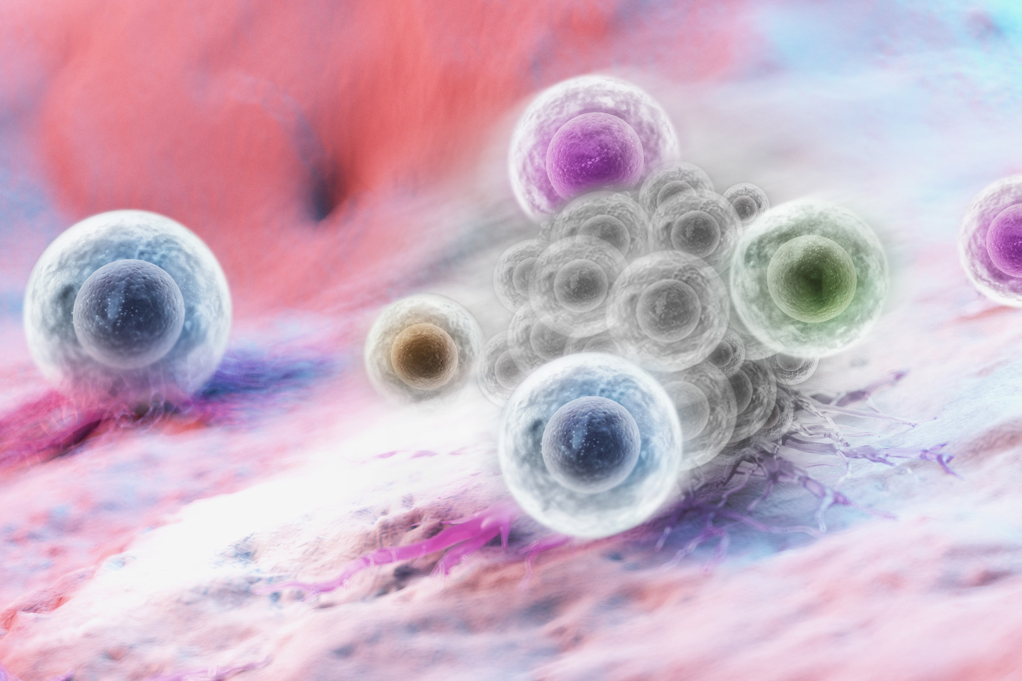 Tumor-infiltrating lymphocytes moving illustrative of TIL infusion